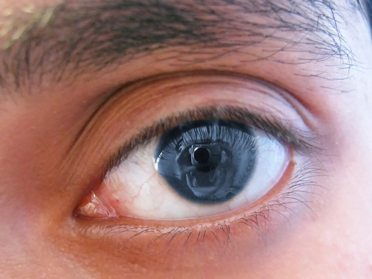 Eye corner irritation: Symptoms, origins, and remedies