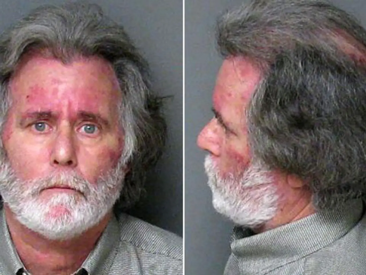 Prostate Cancer Advancement: Prognosis, Therapy, and Resources