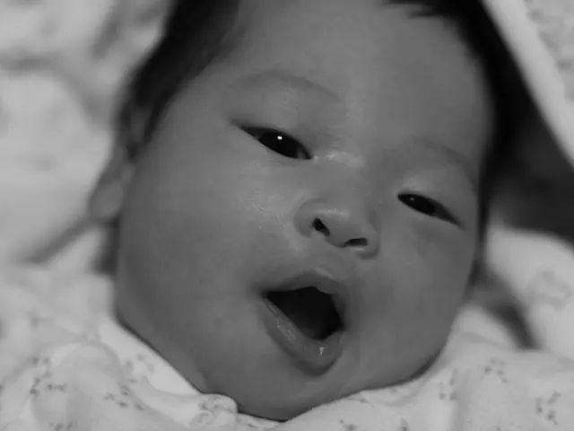 Cleft lip and palate: Origin, medical intervention, and speech development issues