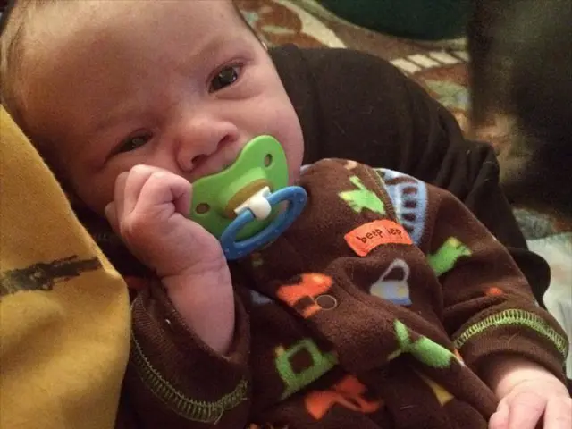 Nipple Irritation: Understanding the Triggers, Solutions, and Relief Strategies