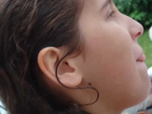 Identifying Freckles, Moles, and Skin Cancer: A Comprehensive Guide on Distinguishing...