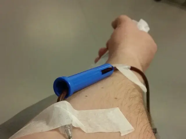 Eligibility for Blood Donation: Criteria and Influencing Factors