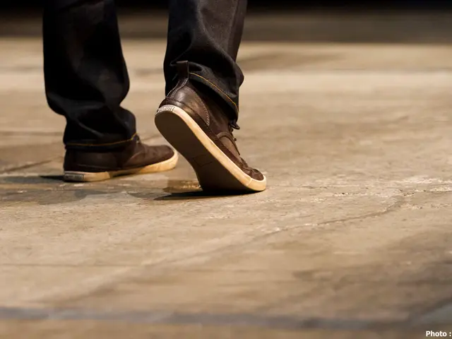 Leg marks from socks: Reasons and remedies explained