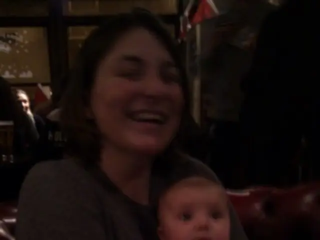 Postnatal Back Pain: Recognizing Instances beyond Regular Postpartum Exhaustion