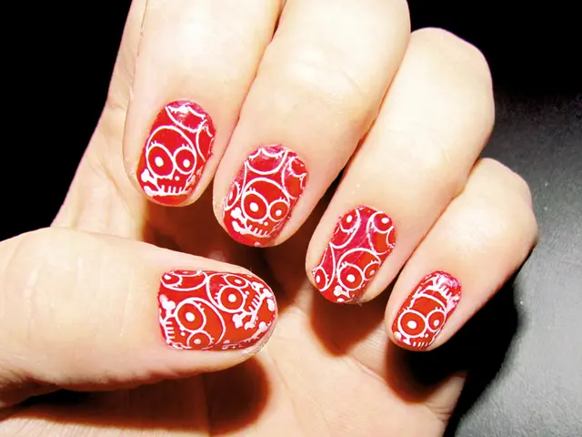 Finger Burn: Recognizing Symptoms, Assessing Gravity, Remedy Options, and When to Consult a...