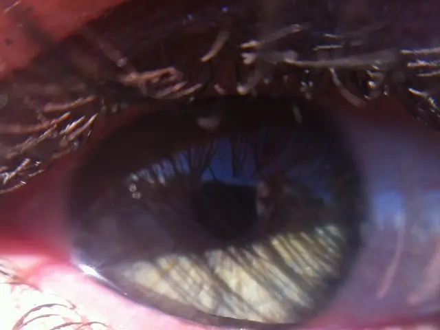 Alleviating Discomfort for Tired Eyes