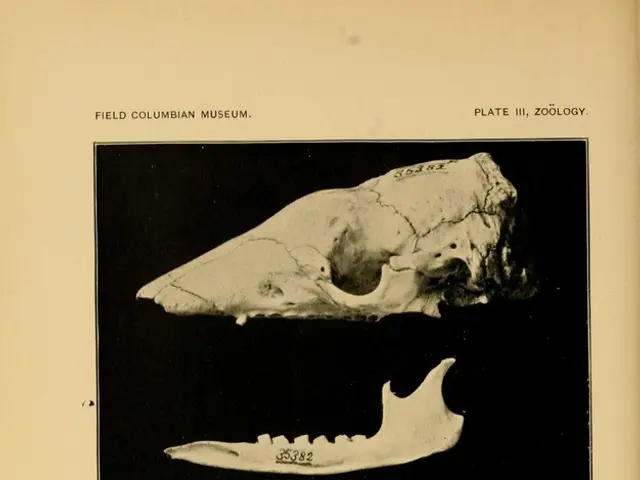 Metastasis of bones in advanced breast cancer