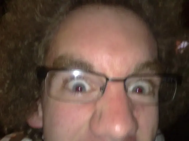 Treatment, concealment, and prevention methods for wrinkles around the eyes (crow's feet)